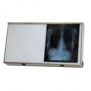 Négatoscope 2 plages JTG - JTG